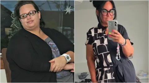 They Shed Pounds Using Injections – Followed By the Loose Skin